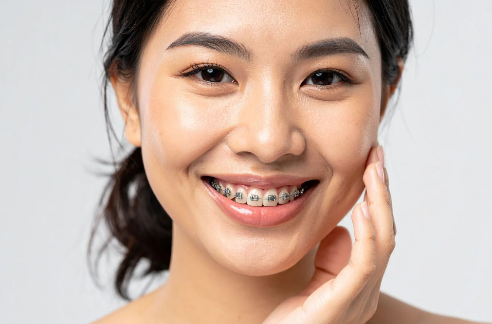 Invisalign & Braces at Blue Orthodontics
