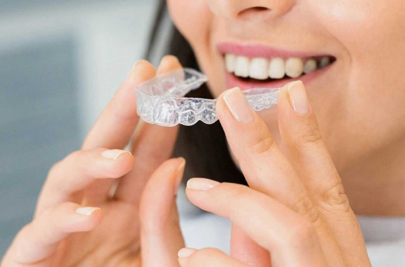 Adult Invisalign Treatment with Monthly Payments